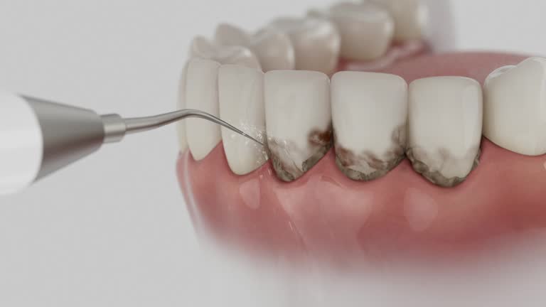 Reliable Wisdom Tooth Removal contractor in Fayette County County, GA by Dentist Open Now